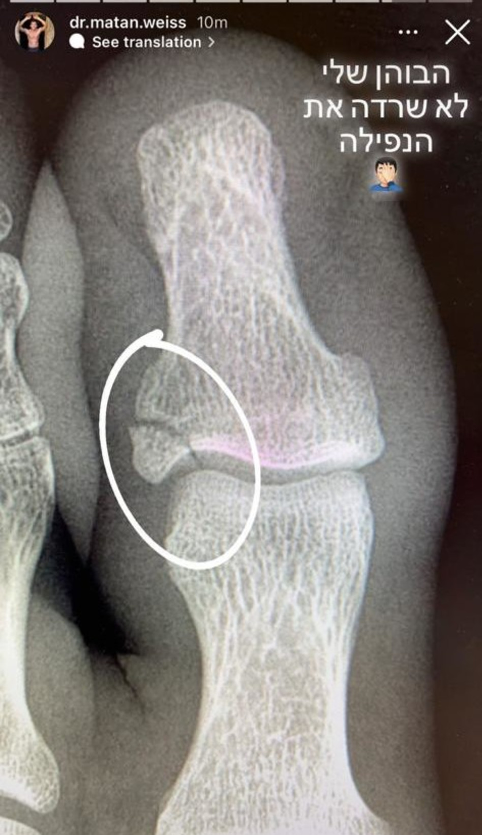 מתן וייס (צילום: צילום מסך אינסטגרם)