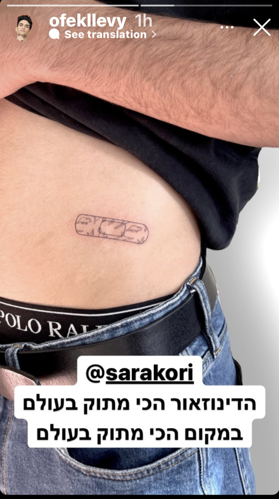 פלסטר על הצלקות (צילום: צילום מסך אינסטגרם)