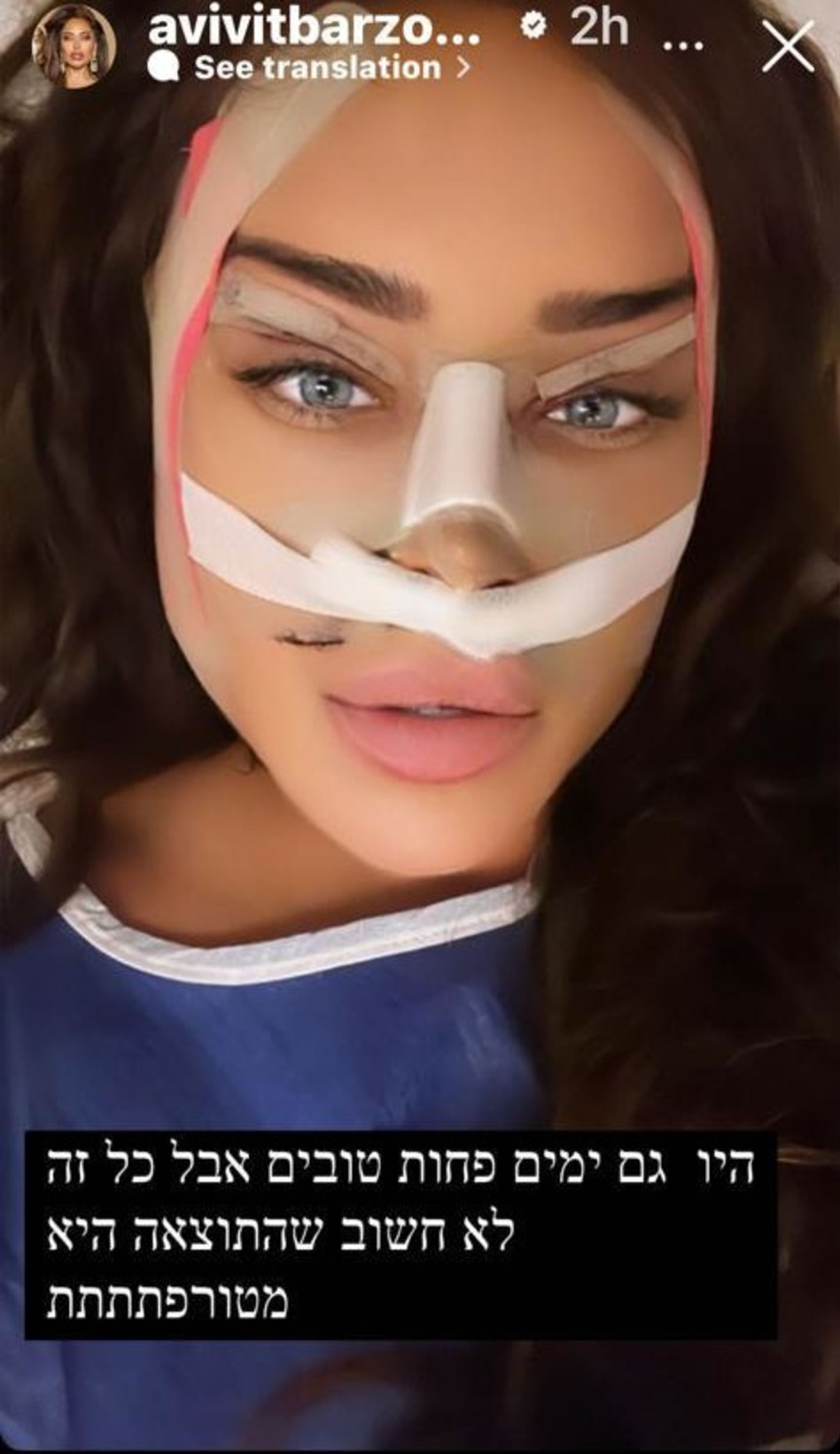 השינוי של אביבית בר זוהר (צילום: צילום מסך אינסטגרם)