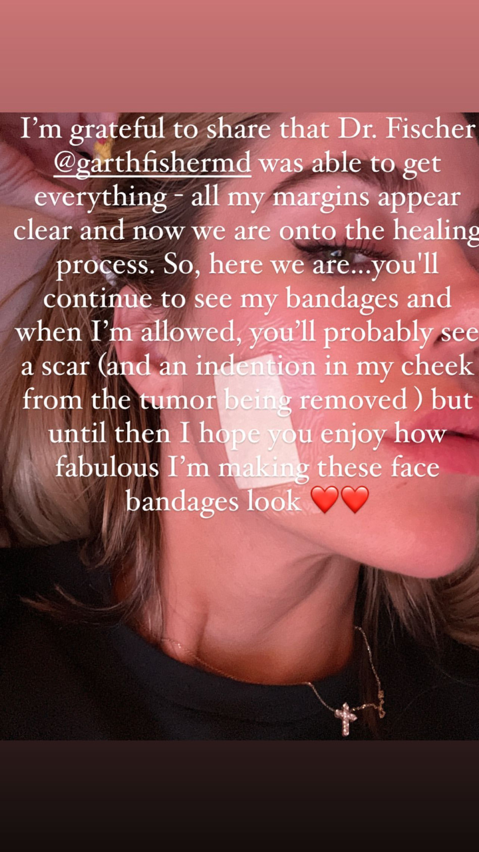 קלואי קרדשיאן חשפה כי גילתה גידול סרטני בפניה (צילום: צילום מסך אינסטגרם)