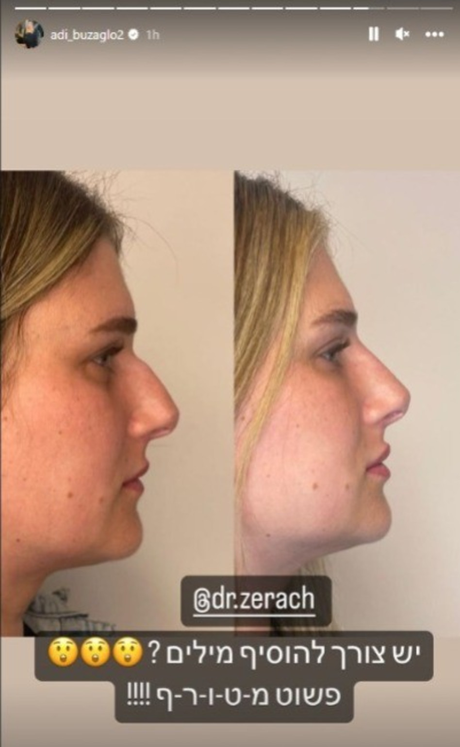 עדי בוזגלו (צילום: צילום מסך אינסטגרם)
