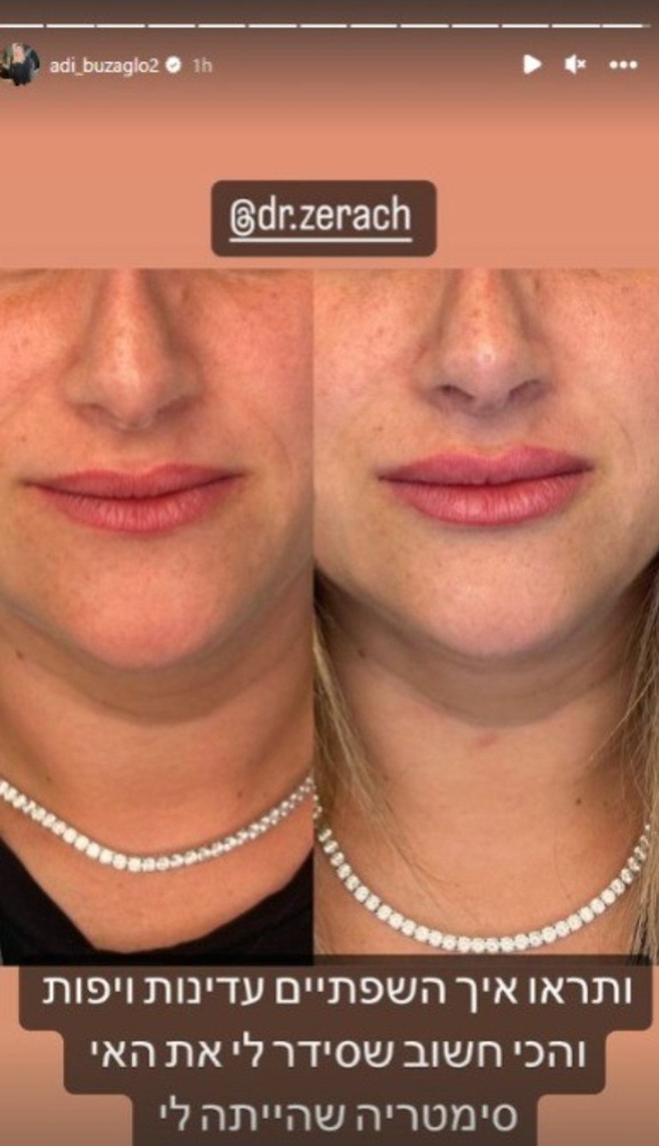 עדי בוזגלו (צילום: צילום מסך אינסטגרם)