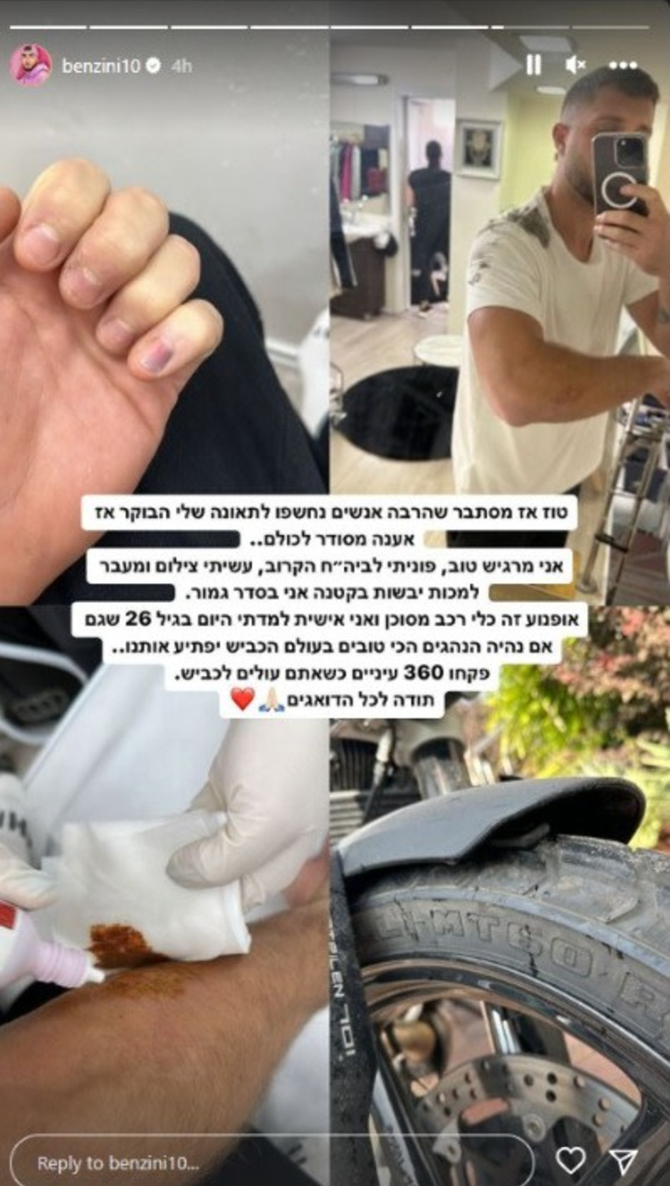בן זיני נפצע בתאונת אופנוע (צילום: מתוך עמוד האינסטגרם של בן זיני)