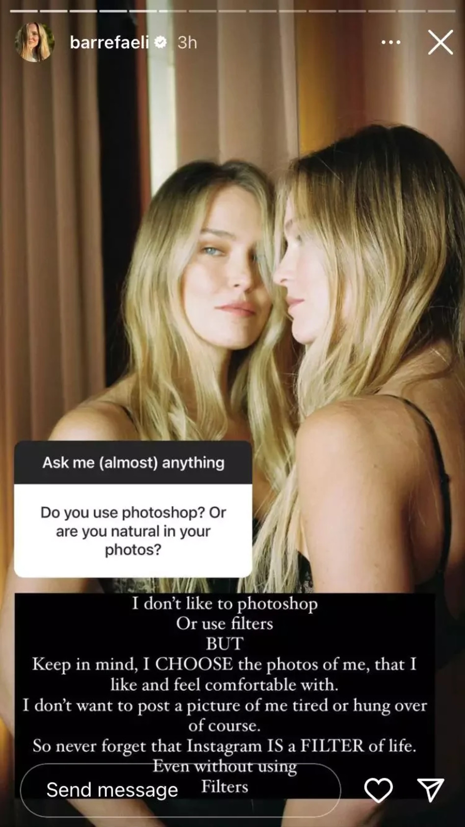 בר רפאלי על פילטרים (צילום: צילום מסך אינסטגרם)