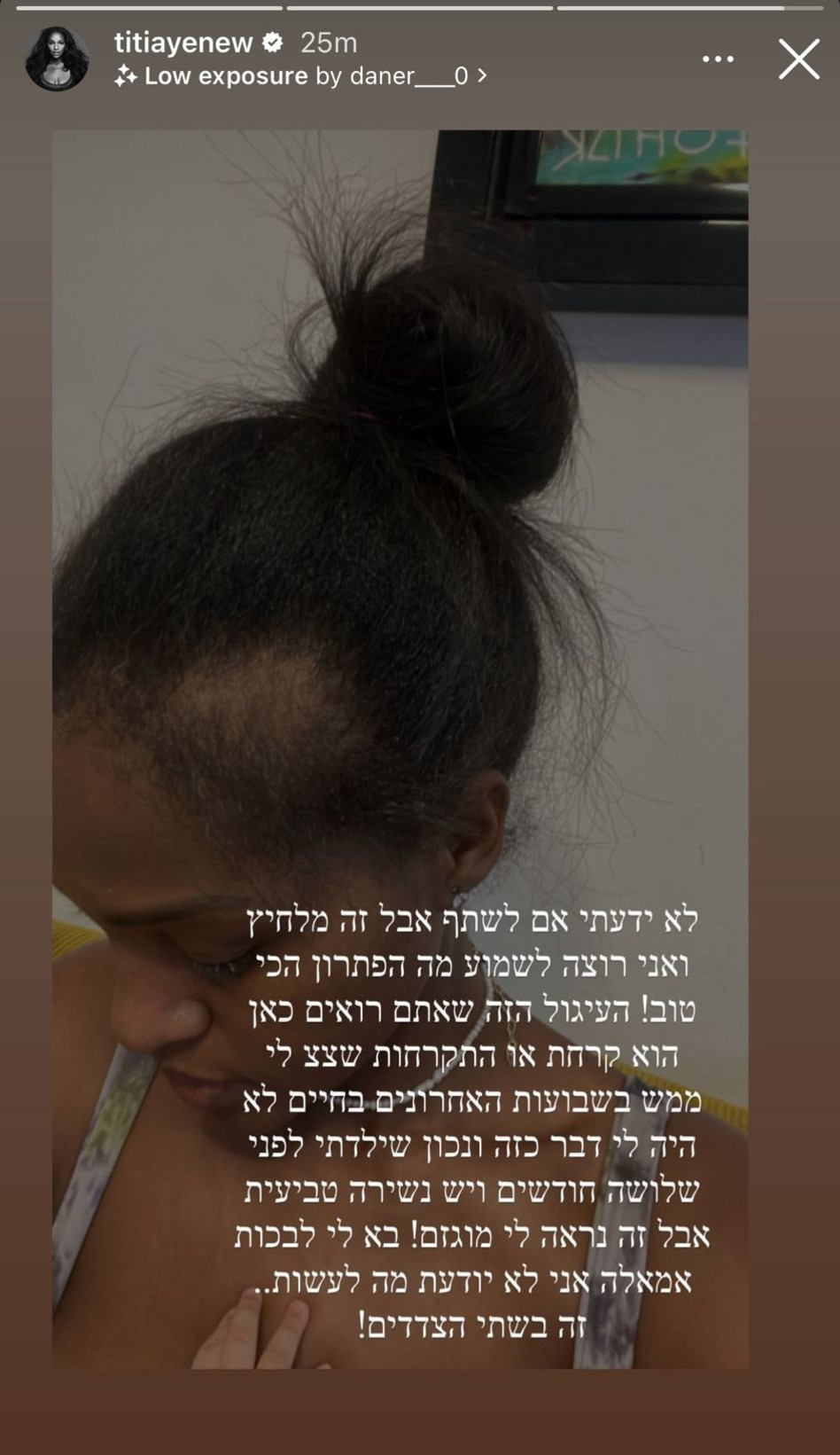 טיטי איינאו חושפת נשירת שיער (צילום: צילום מסך אינסטגרם)