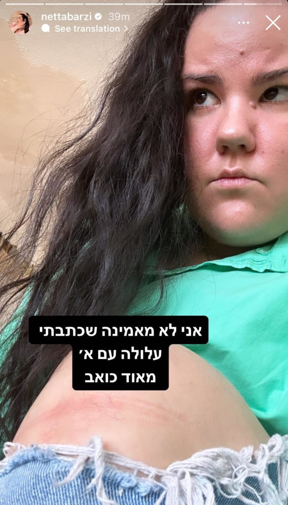 נטע ברזילי על הנפילה הכואבת (צילום: צילום מסך אינסטגרם)