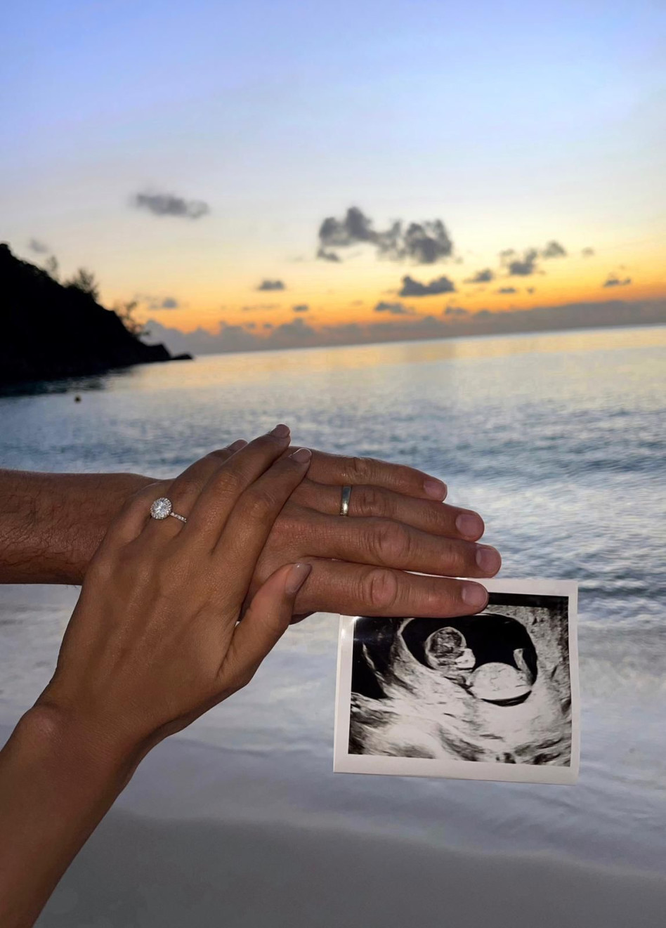 נטע אלחמיסטר חושפת הריון ראשון (צילום: רשתות חברתיות)