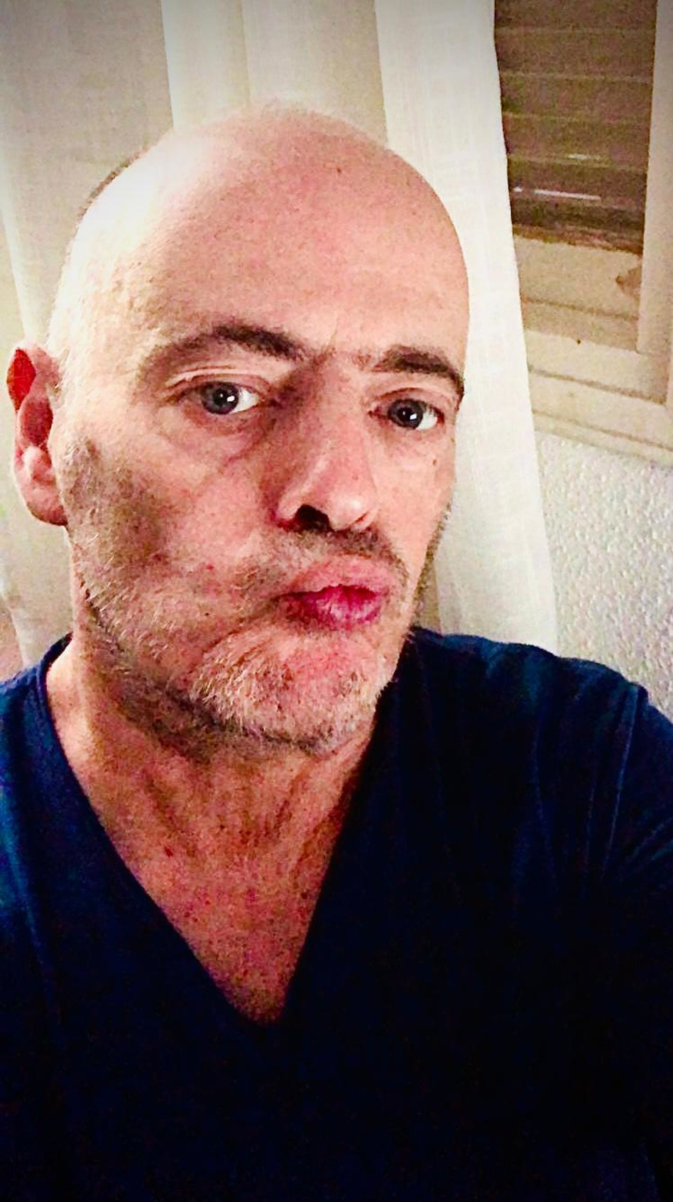 הזמר אדם אחרי טיפולי הכימותרפיה (צילום: צילום מסך פייסבוק)