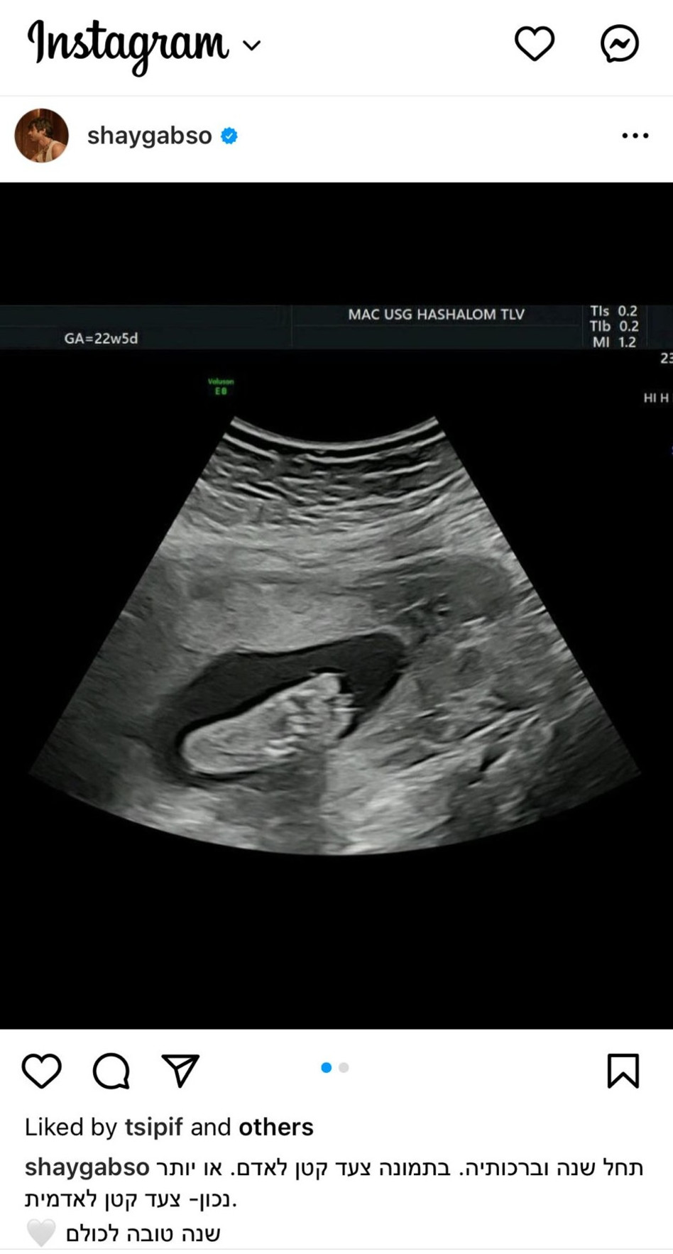 שי גבסו על הולדת בתו הראשונה (צילום: צילום מסך מתוך אינסטגרם)