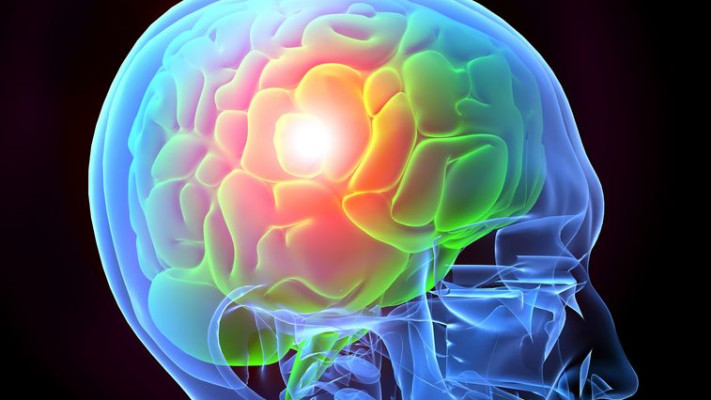 האלצהיימר אילוסטרציה