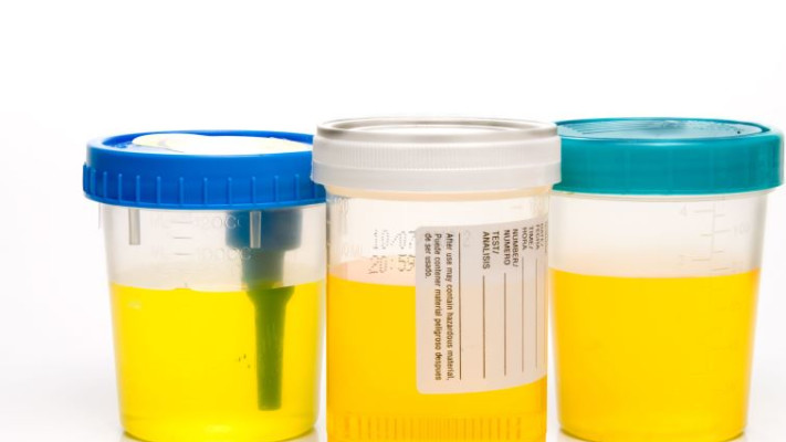 מזעזע: מילאו בקבוקי בושם בשתן 