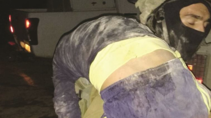 &ldquo;ניסיתי להבין מה גורם לנערה צעירה כל כך לשנוא ככה&quot;. פינוי המחבלת בת ה־15 שנפצעה ביצהר. צילום: ביטחון יצהר