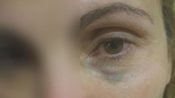 המורה שהוכתה בבאר שבע. צילום: ללא קרדיט