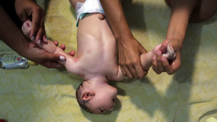 תינוק הסובל מתסמיני הזיקה. צילום: רויטרס