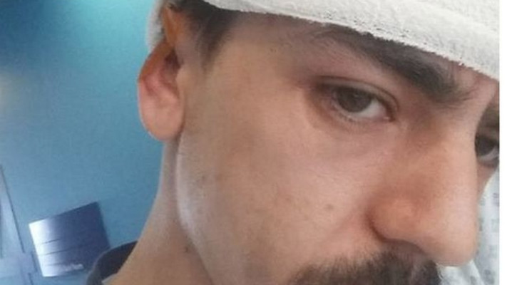 פיני בבית החולים. צילום: מתוך אתר &quot;המירור&quot;