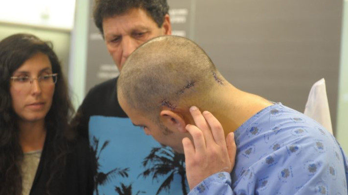 צלקות מהקליעים שפגעו בראשו. אסף בר. צילום: אבשלום ששוני