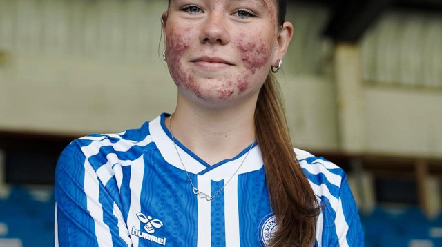 סקיי סטאוט (צילום: צילום מסך, X (טוויטר))