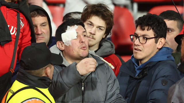 אוהדים פצועים במשחק של אינדפנדיינטה ואוניברסידד דה צ'ילה (צילום: GettyImages, ALEJANDRO PAGNI/AFP)