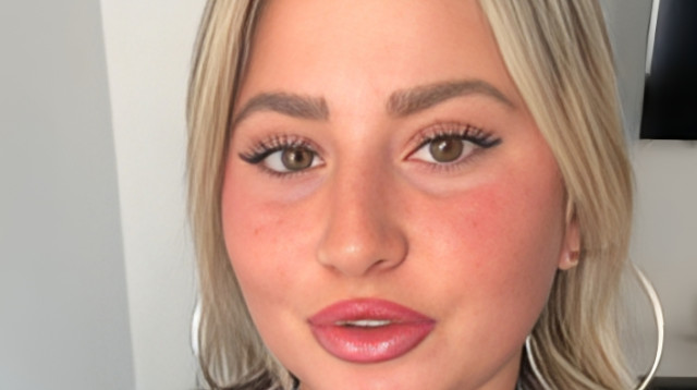 שלקה (צילום: צילום מסך מתוך אינסטגרם)