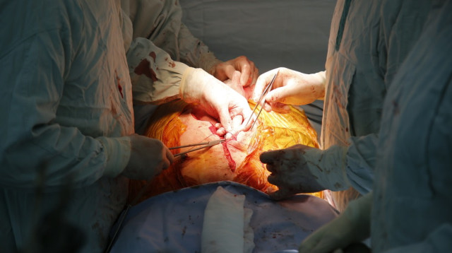 השתלת ריאה (צילום: שאטרסטוק)