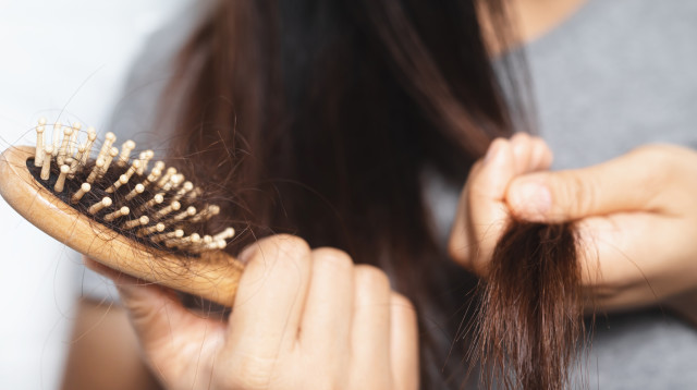 איך ערכת שורשים עוזרת לעצור נשירת שיער? (צילום: Canva)
