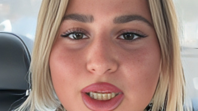 שלקה (צילום: אינסטגרם)