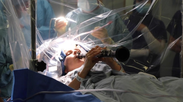 חולה מנגנת על קלרינט באמצע ניתוח מוח (צילום: צילום מסך)