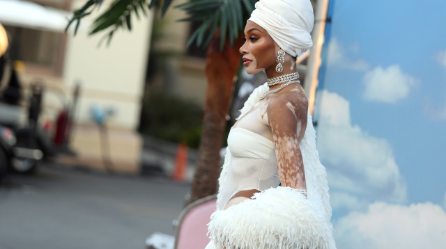 ויני הארלו (צילום: Jerritt Clark/Getty Images for Vogue)