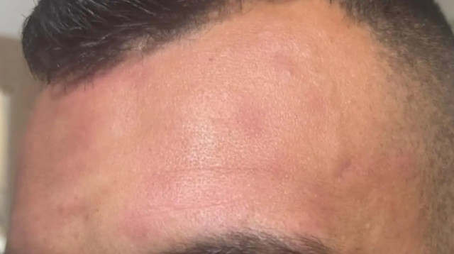 שופט שהותקף לאחר המשחק בני סכנין – מכבי חיפה (צילום: באדיבות המצולמים, .)