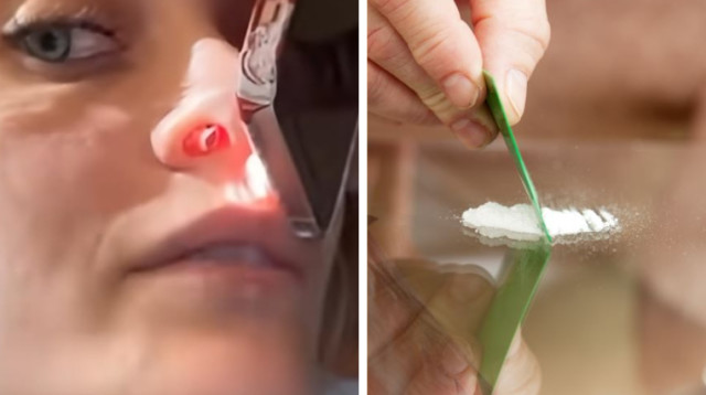 פריס ג'קסון, חור באף (צילום: מימין לשמאל: אינגאימג, קוקאין: אילוסטראציה, רשתות חברתיות)