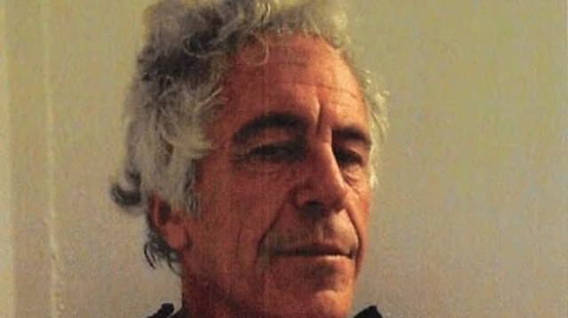 ג'פרי אפשטיין לאחר חשד לניסיון התאבדות (צילום: משרד המשפטים האמריקאי )