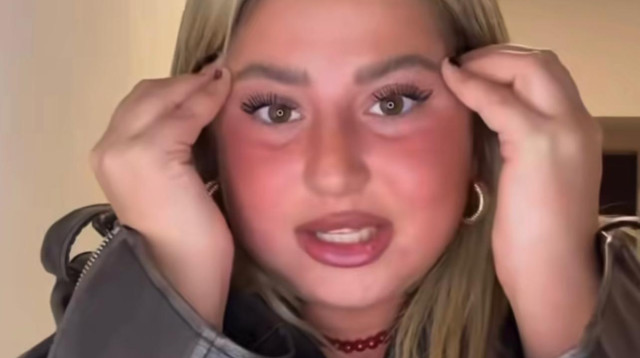 שלקה (צילום: אינסטגרם)