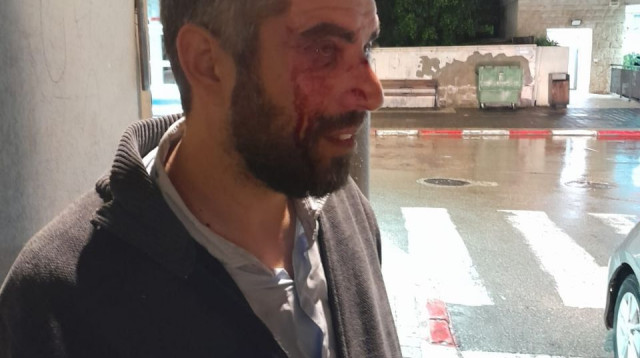 הרב מיפו שהותקף  (צילום: שימוש לפי סעיף 27א')