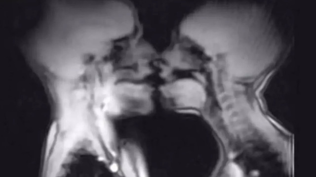 יחסי מין בתוך מכשיר MRI (צילום: צילום מסך)