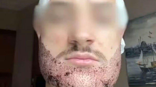 מתיו ויג’ייה לאטור (צילום: רשתות חברתיות)