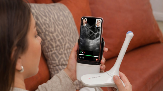 המכשיר החדש. ניטור זקיקים מהבית (צילום: פלסאנדמור)