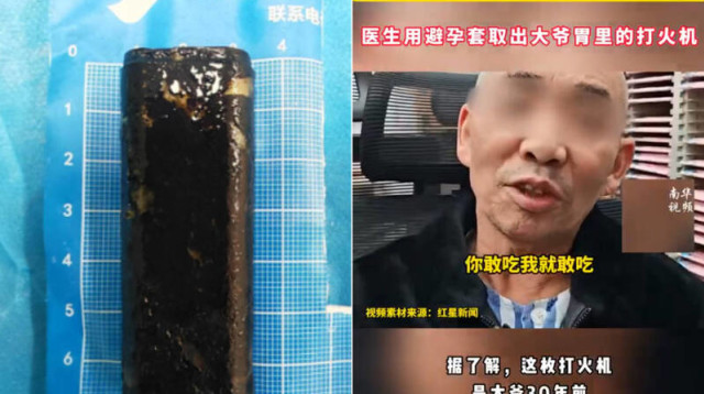 דנג והמצית (צילום: רשתות חברתיות)