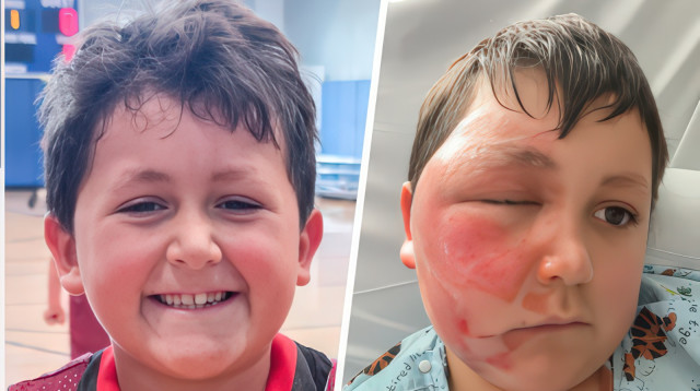 הילד ג'יידן לפני ואחרי הפציעה (צילום: רשתות חברתיות)