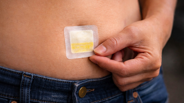 מדבקות הרזייה (צילום: AI)