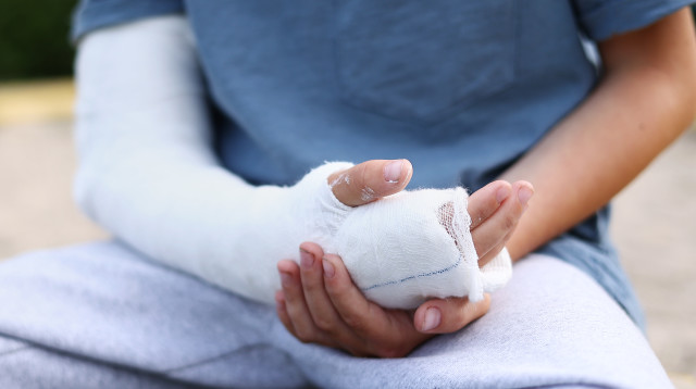 יד מגובסת (צילום: אינגאימג')