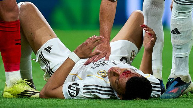 קיליאן אמבפה מדמם על הדשא (צילום: Getty images)