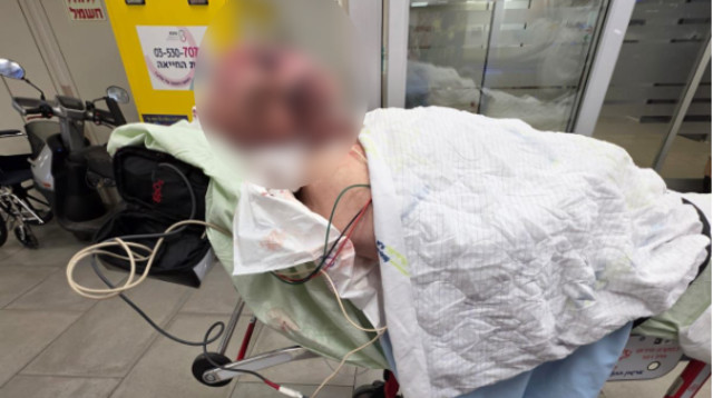 בוריס קוניק. הותקף באכזריות  (צילום: אדוארד קוניק)
