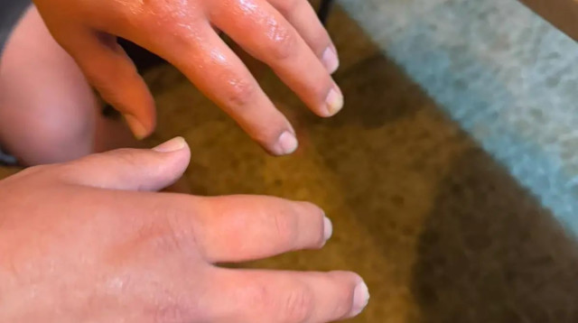 אוהדים של בית"ר ירושלים הותקפו על ידי ערבים ביפו (צילום: באדיבות המצולמים)