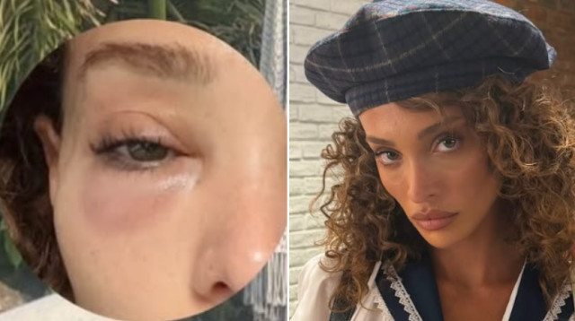 עדן פינס (צילום: צילום מסך אינסטגרם)