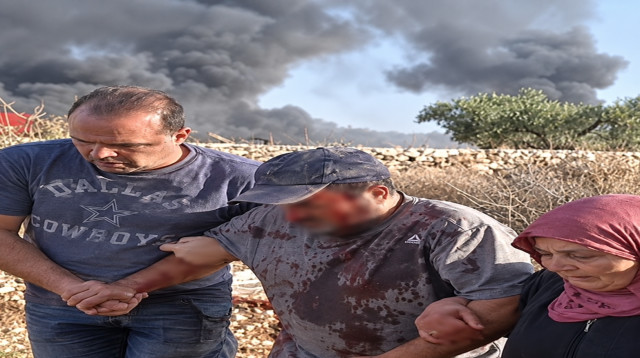 תיעוד מהעימות ביהודה ושומרון (צילום: רשתות חברתיות, שימוש לפי סעיף 27 א')