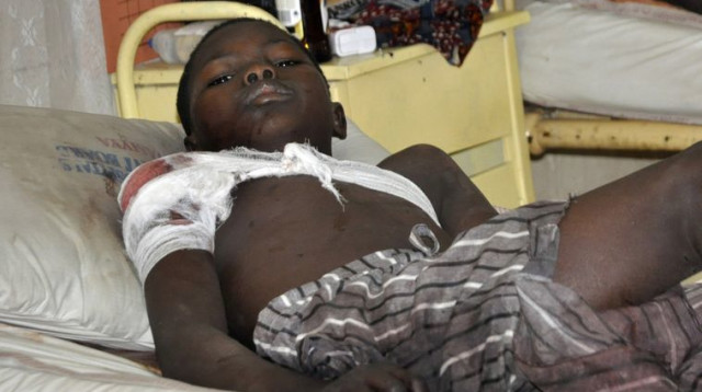 ילד ניגרי שנפצע בהתקפה על מסגד שביצע ארגון הבוקו חראם (צילום: רויטרס)