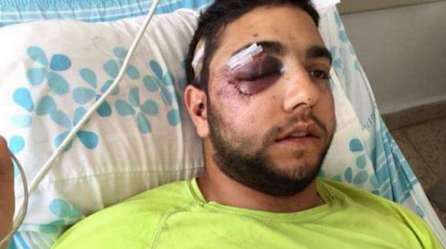 רזי חסיסי בביה"ח (צילום: עמיר חסיסי)