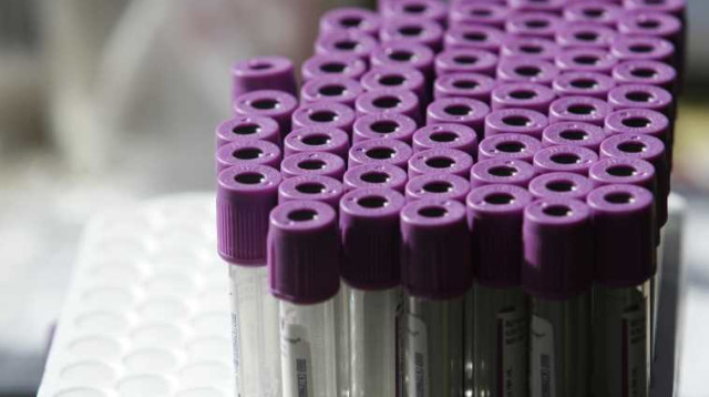 בדיקת דם (צילום: פלאש 90)