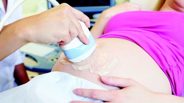 אולטרסאונד בהריון (צילום: אינגאימג)