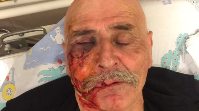 מהנא שמס שהותקף ע"י זאב (צילום: באדיבות המרכז הרפואי זיו)